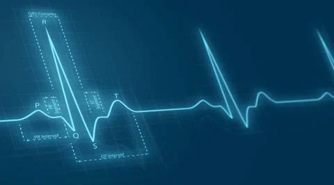Cardiogram Stock Illustration