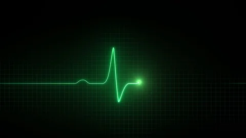 Cardiogram. Loop. Stock Footage 115956278