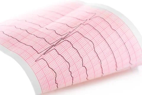 Cardiogram. Macro of ECG graph Cardiogram. Macro of ECG graph Copyright: x... Stock-Fotos