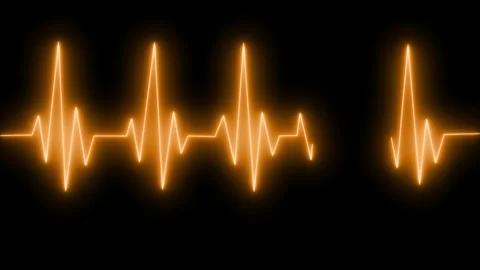 Cardiogram Neon Animation Glowing Pulse Line in Motion, Glowing Medical Hea.. Stock Footage 313753922
