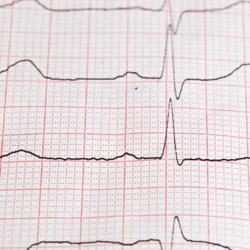 Cardiogram Stock-Fotos