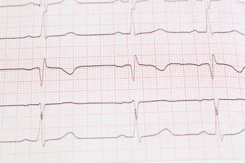 Cardiogram Stock Photos