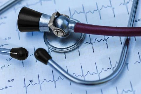 Cardiogram pulse trace and stethoscope concept for cardiovascular medical exa Stock Photos