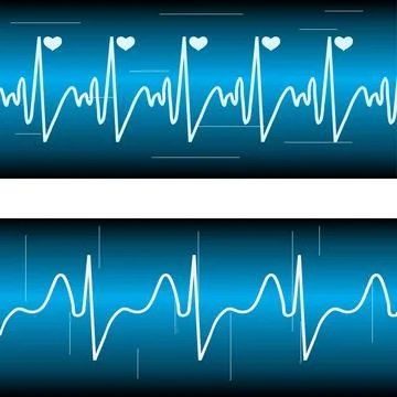 Cardiogram, a set of cardiogram heart on a dark background. Stock Illustration