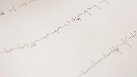Cardiogram on a sheet of paper moves out of the measuring device. Stock Footage 131184053