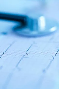 Cardiogram with stethoscope Stock Photos