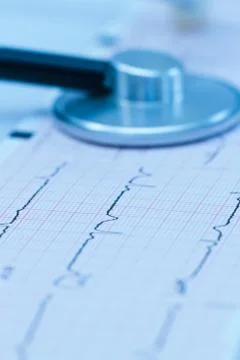 Cardiogram with stethoscope Stock Photos