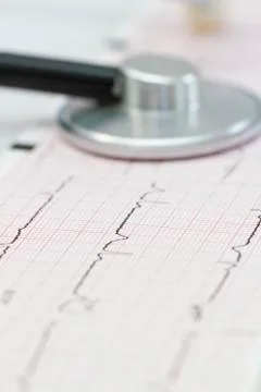 Cardiogram with stethoscope Stock Photos