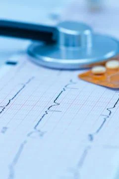 Cardiogram with stethoscope Stock Photos