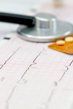 Cardiogram with stethoscope Stock-Fotos