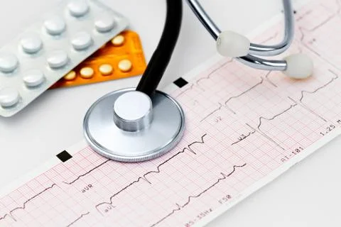 Cardiogram with stethoscope Stock Photos