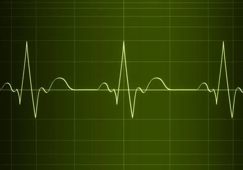 Cardiogramm Stock Illustration