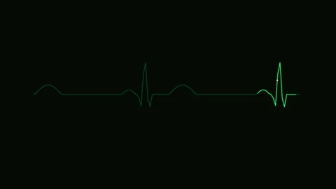 Cardiograph green glowing pulse line on black background for medical Video stock 345569820