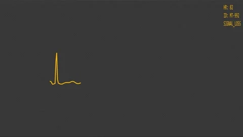 Cardiograph recording Stock Footage 337733217