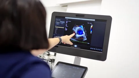 Cardiologist pointing the screen while performing an echocardiogram Vídeos de archivo 260510256