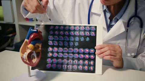 Cardiologist sitting at the table and explain the disease in hospital Stock Footage 251941261