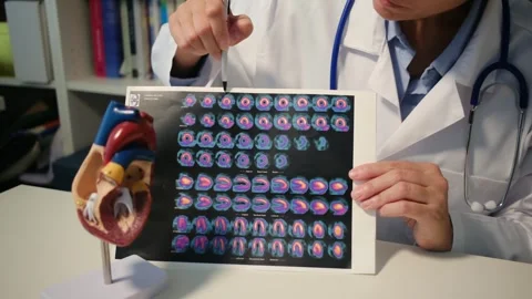 Cardiologist sitting at the table and explain the disease in hospital Stock-Footage 251941264