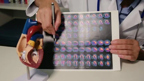 Cardiologist sitting at the table and explain the disease in hospital Stock Footage 251941299