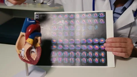 Cardiologist sitting at the table and explain the disease in hospital Stock Footage 251941300