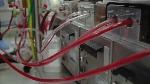 Cardiopulmonary bypass Vidéo 169050807
