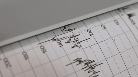 The cardiotocography device draws a heartbeat graph. The cardiotocography device Stock Footage 163166554
