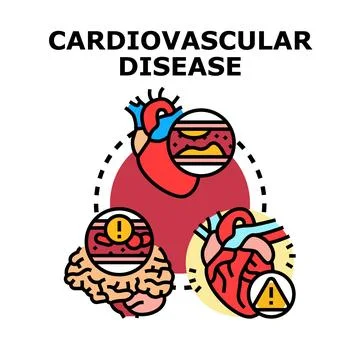 Cardiovascular disease concept affecting heart and brain health Stock Illustration