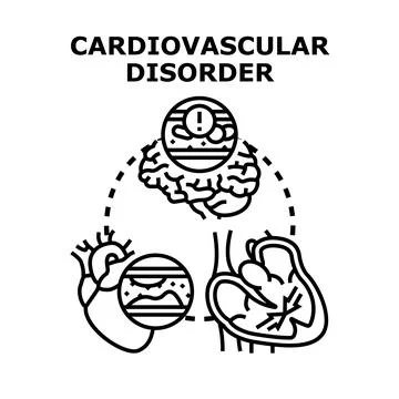 Cardiovascular disorder concept causing heart attack and stroke Stock Illustration