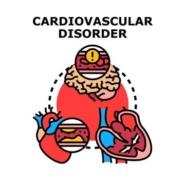 Cardiovascular disorder concept causing heart attack and stroke Stock Illustration