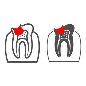 Caries line and solid icon, Human diseases concept, Inflammation of tooth sign イラスト素材