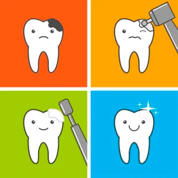 Caries treatment Process Stock Illustration