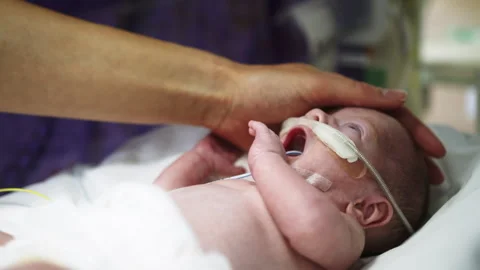 Caring for a Newborn in NICU Stock Footage 311828973