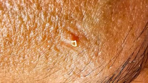 Carnation on the forehead Foto stock