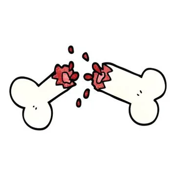 Cartoon doodle snapped bone Illustrazione stock