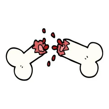 Cartoon doodle snapped bone Illustrazione stock