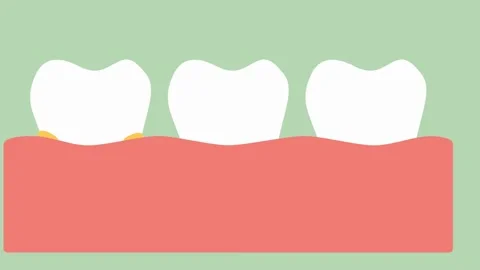 Cartoon illustration of three teeth with... | Stock Video | Pond5