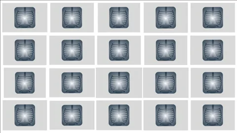 Cartoon seamless x-ray pattern background in  4k video. Stock-Footage 145746300