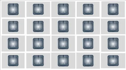 Cartoon seamless x-ray pattern background illustration. イラスト素材