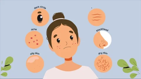 Cartoon Skin Problems Care Animation Stock Footage 252550125
