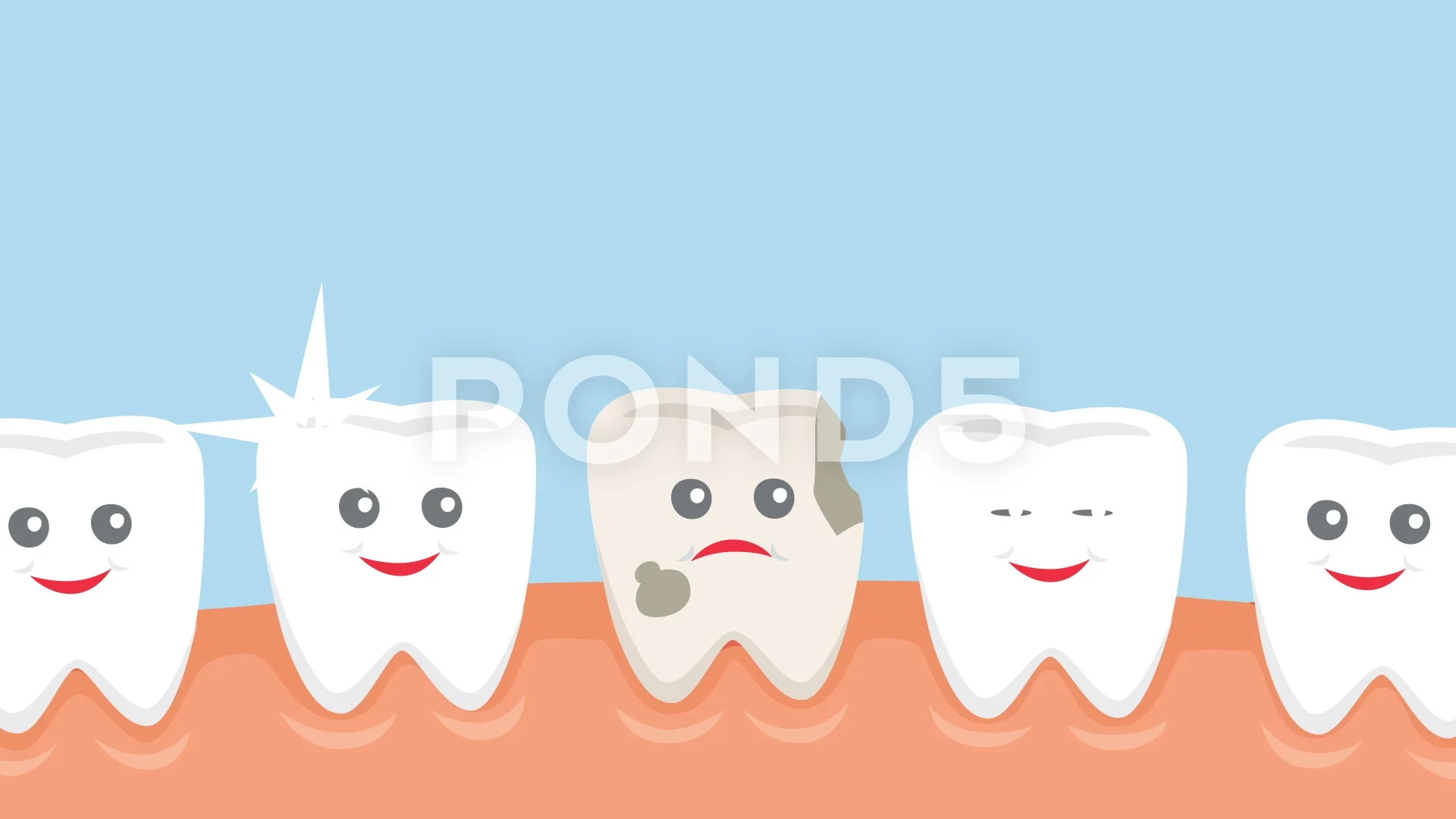 dental caries animation