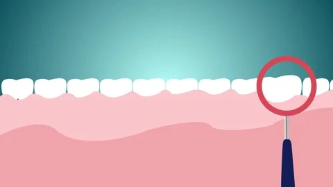 Cartoon teeth cleaning with toothpaste and toothbrush oral hygiene. Teeth under Stock Footage 315182766