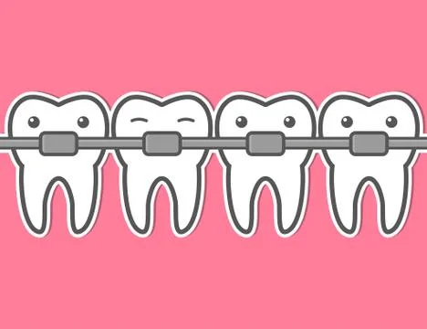 Cartoon tooth braces. Stock Illustration