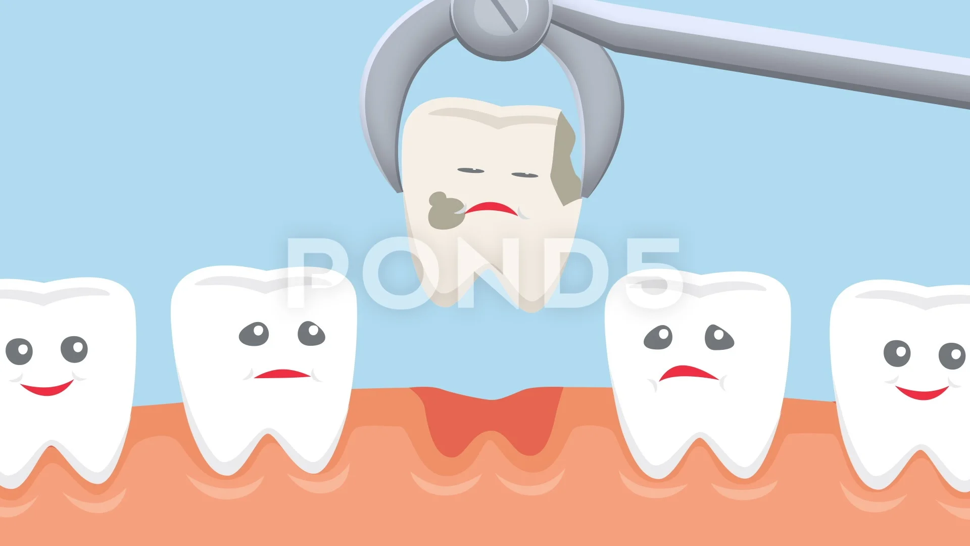Cartoon tooth extraction dental animatio... | Stock Video | Pond5