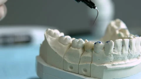 Casting of the jaw Stock Footage 94382774