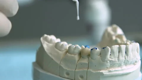 Casting of the jaw Stock Footage 94383044