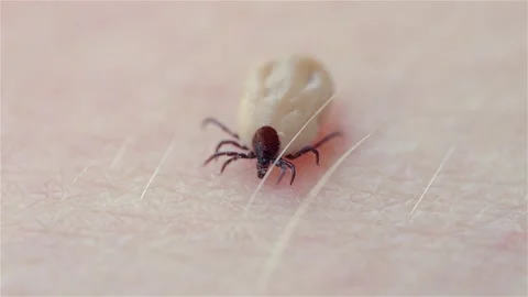 A castor bean tick (Ixodes ricinus) crawls on human skin. The parasite atta.. Vídeos de archivo 329938136