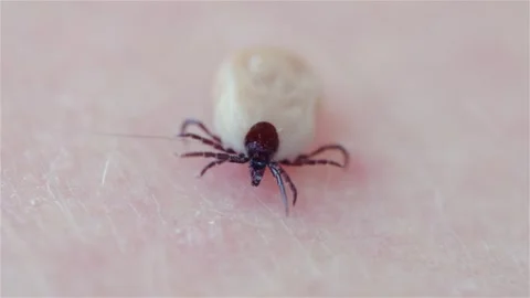 A castor bean tick (Ixodes ricinus) crawls on human skin. The parasite atta.. Vídeos de archivo 329938146