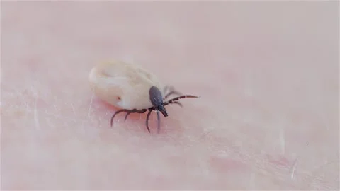 A castor bean tick (Ixodes ricinus) crawls on human skin. The parasite atta.. Stockbeeldmateriaal 329938161