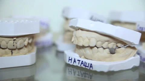 Casts for dentures Stock-Footage 65059519