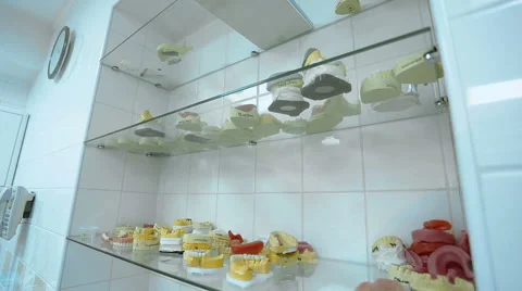Casts of the teeth and jaws in prosthetic dentistry Stock Footage 67559414