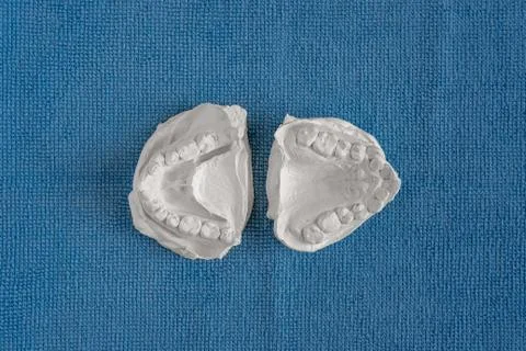 Casts of teeth in the center on a blue background. Foto stock